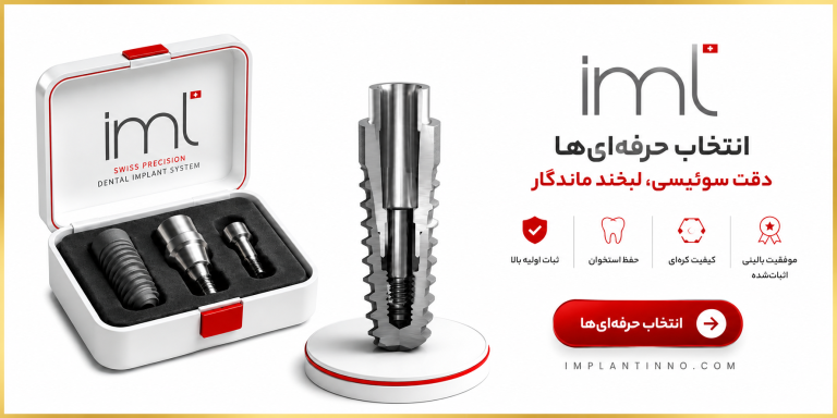 IML IMPLANT
