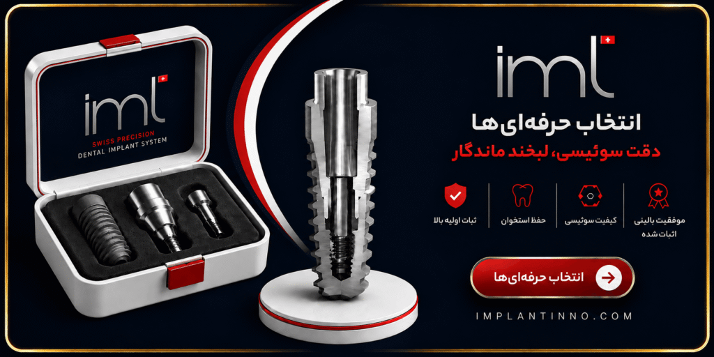 ایمپلنت iml